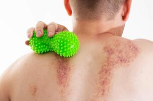 Self-massage with a green massage roller on the skin of a man s back, close-up, erythema photo