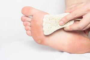 A person removes scrubs dry calluses and natograms from the sole of a foot with pumice stone, close-up, treatment, copy space, problem photo