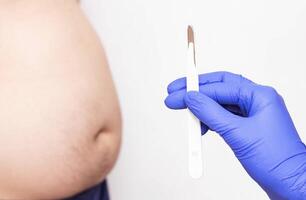 Doctor holds a scalpel on the background of a fat and fat male abdomen, the concept of the operation of gastrectomy, stomach photo