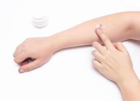 Man smears a medical hormone ointment with a gray red sore pimple on his hand, white background, copy space, dermatology photo