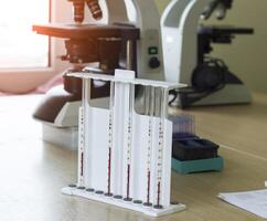 blood test for ESR microscopes, medicine and blood, virus nipah photo