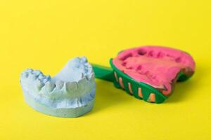 Dental spoon with alginate plastic mass for taking an impression of the dental jaw on a yellow background. Blue plaster dental jaw on a yellow background. Orthodontics in dentistry photo