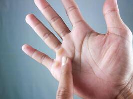 closeup of fingers shows callus hands from working hard photo