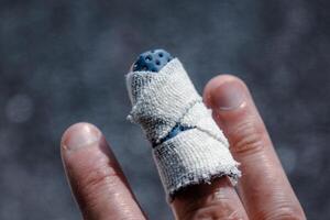 Mallet finger with custom orthosis on the middle finger to immobilize the last phalanx following joint trauma photo