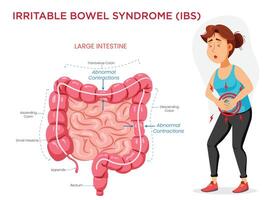 Irritable Bowel Syndrome Visualizing Symptoms with an Intestine Diagram vector