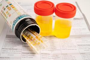 Urinalysis, urine cup with reagent strip pH paper test and comparison chart in laboratory. photo