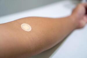 Close up of medical tape on hand.. A medical adhesive bandage is placed on the injection site after blood sample collection to prevent bleeding and maintain cleanliness. photo