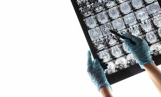 Magnetic resonance image MRI of the brain. The indicators are good, healthy. A doctor in gloves photo