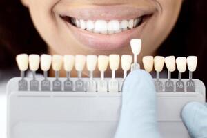 Unrecognizable Dentist In Sterile Gloves Holding Dental Teeth Shade Guide Chart, Choosing Right Emanel Color For Black Female Patient During Whitening Treatment In Modern Clinic, Closeup Shot photo
