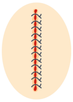 Collection of round icons representing various sutured wounds in different configurations, showing the process of surgical suture healing. png