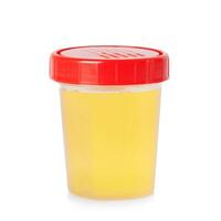 Urine sample in container photo