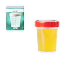 Urine sample in container photo