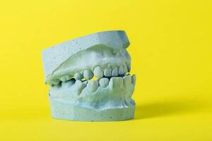Blue cast of a dental jaw on a yellow background, close-up. Concept of taking dental impressions for making crowns for dental prosthetics. photo