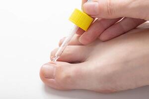 Application of a cosmetic product to the toenail to strengthen the nail and cuticle, vitamin complex. Copy space for text, inflammation photo