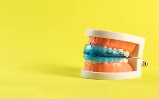 Dental mouth guard for bruxism with a mock-up of a dental jaw on a yellow background. Concept for treatment and protection of teeth from grinding during sleep in children. photo