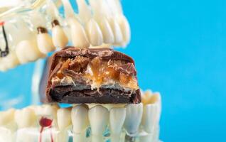 A bitten chocolate bar in a dental jaw mockup on a blue background. The concept of sweets harming tooth enamel, caries. Copy space for text photo