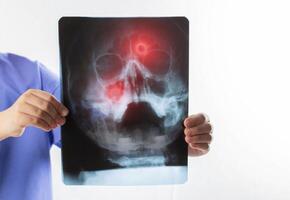 X-ray image showing red spots of inflammation of the maxillary sinuses in a child. Sinusitis in children. Treatment of runny nose and colds. Copy space for text photo