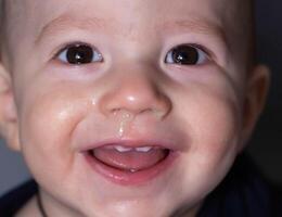 Face of a smiling baby boy with snot from his nose. Runny nose and nasal congestion in children. Virus and bacterial infection, close-up photo