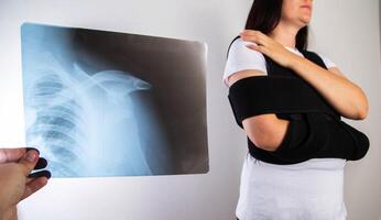 The doctor holds in his hand a medical x-ray of a dislocated humerus and a fractured collarbone against the background of a girl patient whose shoulder hurts. Fixing bandage for the shoulder joint. photo
