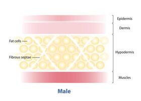 Diagram of Fibrous septae in men skin structure illustration on white background. The septae of men are oriented at 45 angles to the skin in a crisscrossing pattern, horizontally, diagonally. vector