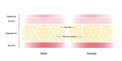 Diagram of gender differences in men and women skin structure illustration on white background. The fibrous septae of men run horizontally or diagonally, while in women run vertically. vector