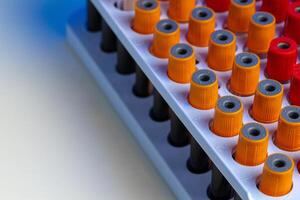 Blood test tubes in lab close up photo