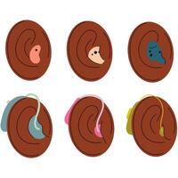 Dark-skinned ears with hearing aids, promoting diversity and accessibility.Health medical device vector