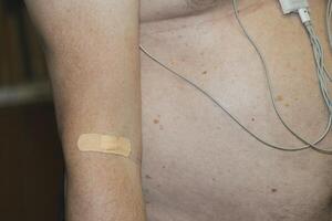 Arm with bandage and medical device attached during health monitoring photo