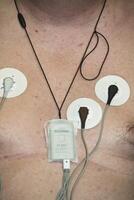 Electrodes attached to a chest during a medical procedure for monitoring photo