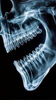 Detailed view of human skull demonstrating jaw structure in X ray imaging photo