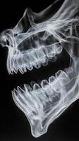 Detailed view of human skull demonstrating jaw structure in X ray imaging photo
