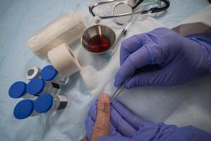Stitched finger with medical instruments, about to remove sutures photo