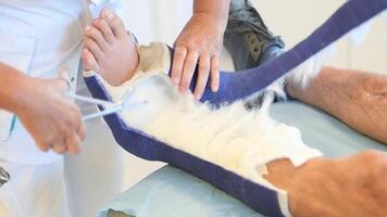 Nurse in clinic carefully cutting fiberglass cast and bandages underneath on patient's leg with scissors following instructions, taking precautions, professional care concept, video