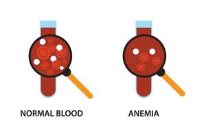 Anemia problem circulatory iron body diagram background vector