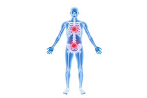A human figure with a visible skeletal structure and highlighted areas indicating pain or focus points in the torso. png