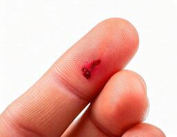 close-up of a shallow paper cut on a fingertip with visible redness and detail isolated on white background photo