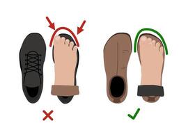 Barefoot shoes. Compare regular vs barefoot shoes. This shoe has a flexible upper and outsole that allows the feet to move and flex naturally, and effectively engage every bone vector