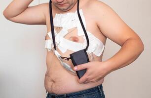 Cardiological procedure for the study of the heart Holter monitoring. Identification of heart diseases, blood supply and disorders of the heart, heart failure. photo
