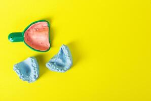 Blue plaster cast of a dental jaw and a dental tray for an impression of a dental jaw on a yellow background. The concept of orthodontics in dentistry, the manufacture of dentures and crowns. photo