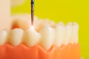 Drilling a diseased tooth with caries with a drill in dentistry during dental treatment, macro. Caries and pulpitis. Copy space for text, modern technology photo