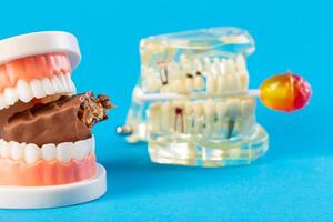 Two mock-ups of dental jaws with a lollipop and a chocolate bar on a blue background. The concept of the destructive effect on tooth enamel and teeth after eating sweets. photo