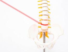 Mock up human spine on a white background with a laser. The concept of a new modern method without surgery for the treatment and removal of intervertebral hernias, copy space photo