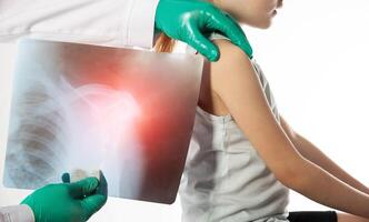 The hands of a doctor orthopedic traumatologist in green gloves holds an x-ray of a girl with a dislocated shoulder and a fracture of the shoulder. Trauma and sprain, close-up photo