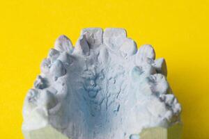 Blue plaster impression of a patient's dental jaw with crooked teeth and malocclusions on a yellow background. Manufacturing of braces to correct bite. View from above. Copy space for text photo