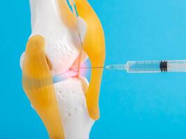 Drug blockade in a mock-up of the knee joint on a blue background. The concept of treating joints with blood plasma, plasma lifting. Introduction of hylaronic acid for joint rejuvenation. photo