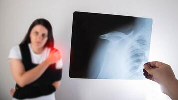 The doctor holds in his hand a medical x-ray of a dislocated humerus and a fractured collarbone against the background of a girl patient whose shoulder hurts. Fixing bandage for the shoulder joint. photo