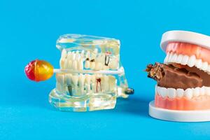 Two mock-ups of dental jaws with a lollipop and a chocolate bar on a blue background. The concept of the destructive effect on tooth enamel and teeth after eating sweets. Caries and pulpitis photo
