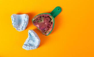 Blue plaster cast of a dental jaw and a dental tray for an impression of a dental jaw on a yellow background. The concept of orthodontics in dentistry, the manufacture of dentures and crowns. photo