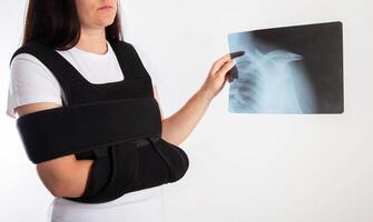 A girl holds an X-ray of a dislocation and fracture of the humerus in a bandage on the shoulder joint after a surgical operation. Copy space for text photo