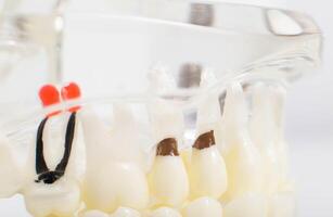 Dummy jaw with root canals, caries and pulpitis, macro. Hygiene photo